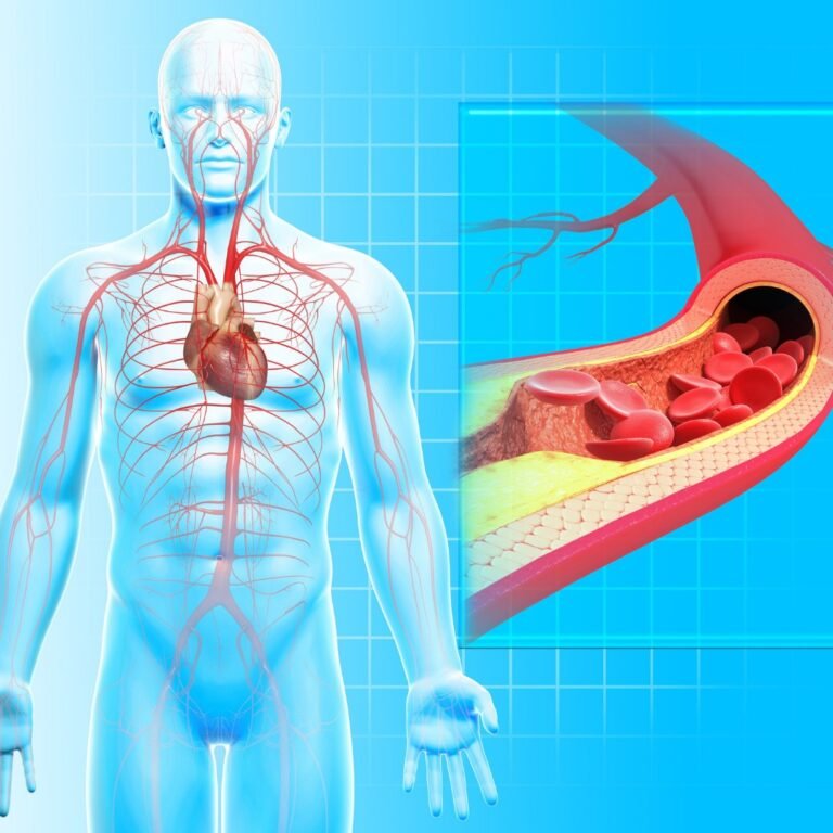 Peripheral Artery Disease Treatment in India