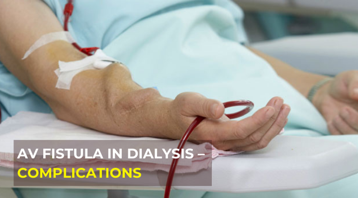 Fistula Dialysis Port