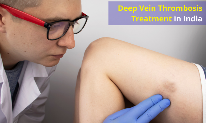 deep vein thrombosis