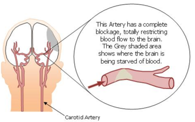 9 Amazing Procedures Performed by Interventional Radiologists 2.jpg