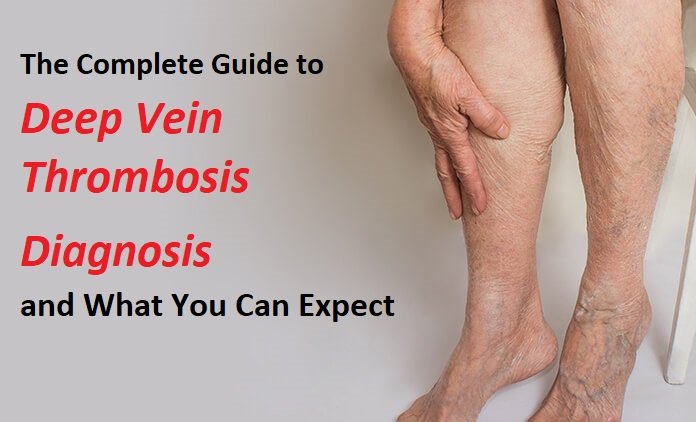 What is Deep Vein Thrombosis