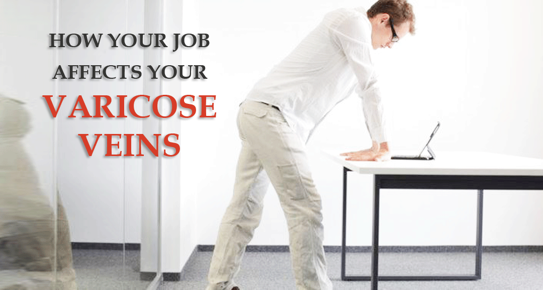 How your Job Affects your Veins
