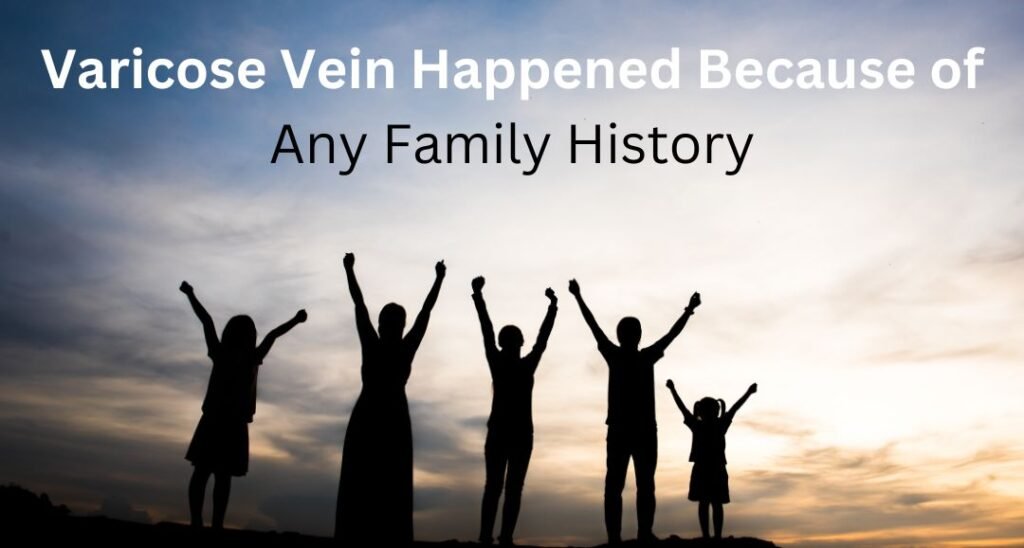 Does Varicose Vein Happened Because of any Family History?