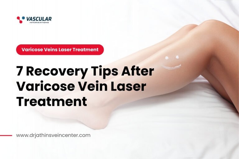 7 Recovery Tips After Varicose Vein Laser Treatment