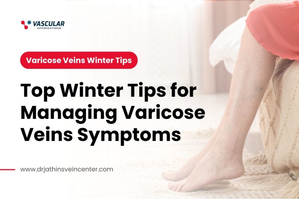 Top Winter Tips for Managing Varicose Veins Symptoms