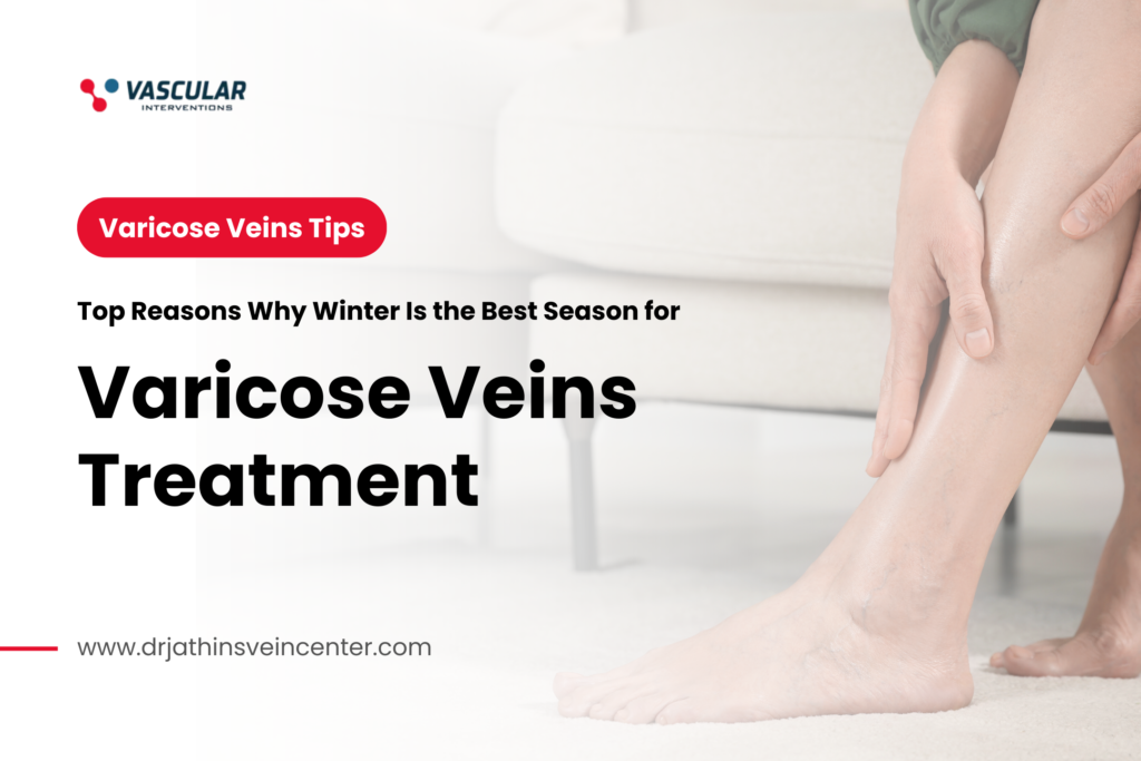 Top Reasons Why Winter Is the Best Season for Varicose Veins Treatment