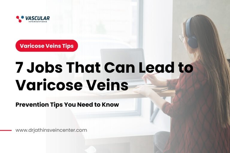 7 Jobs That Can Lead to Varicose Veins: Prevention Tips You Need to Know