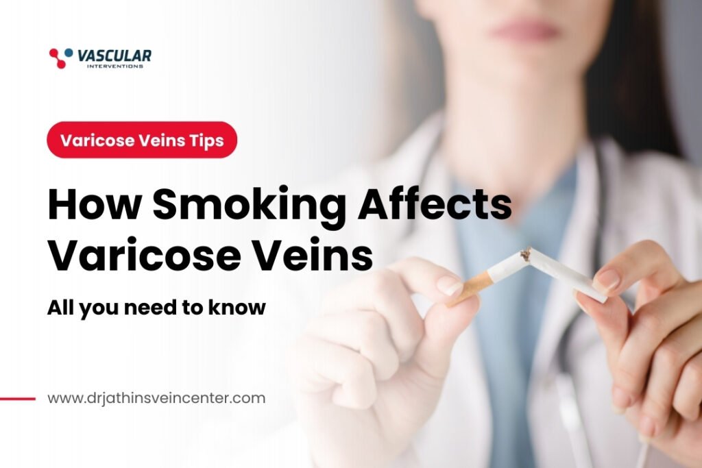 How Smoking Affects Varicose Veins All you need to know