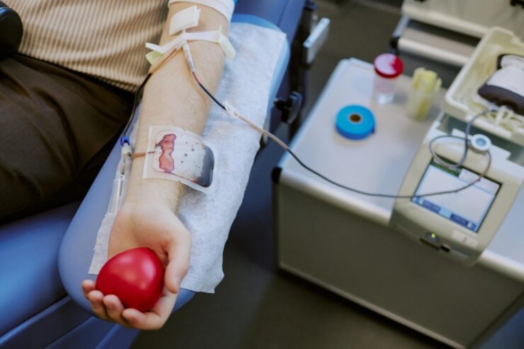 Arteriovenous Fistula Access for Dialysis