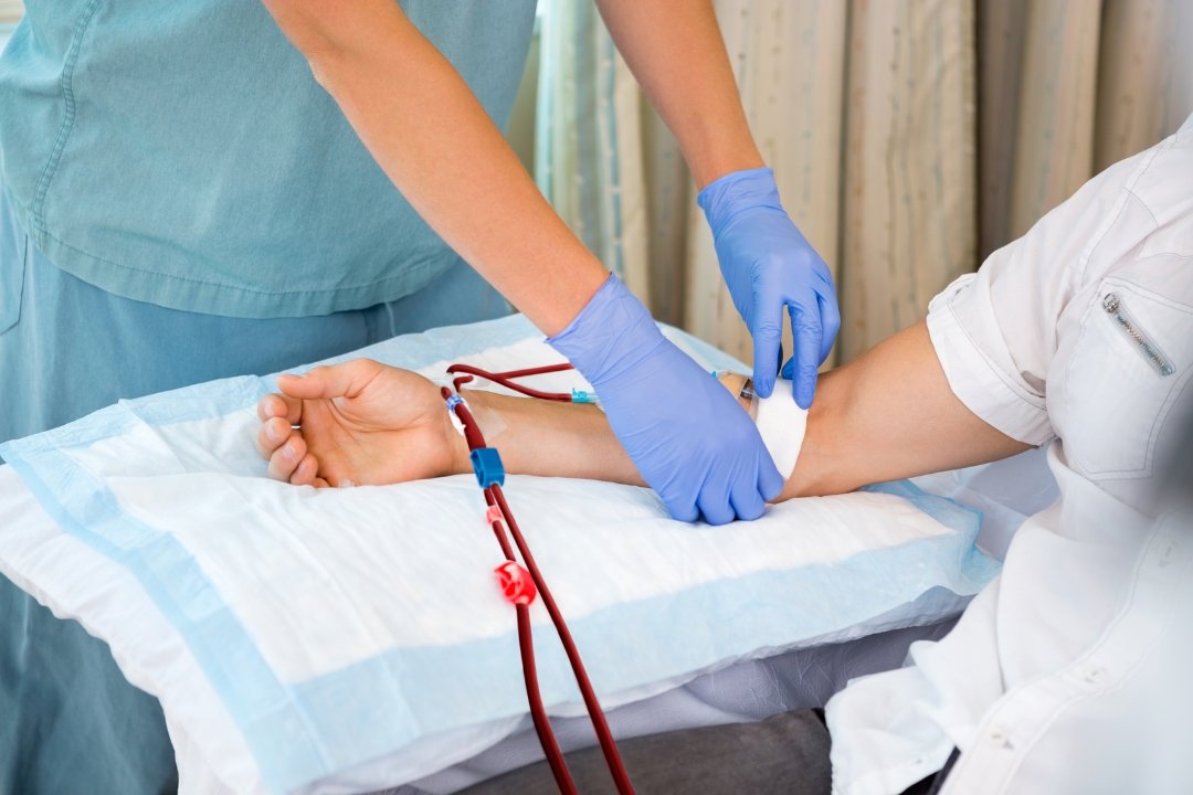 Revascularization of Dialysis AVFs