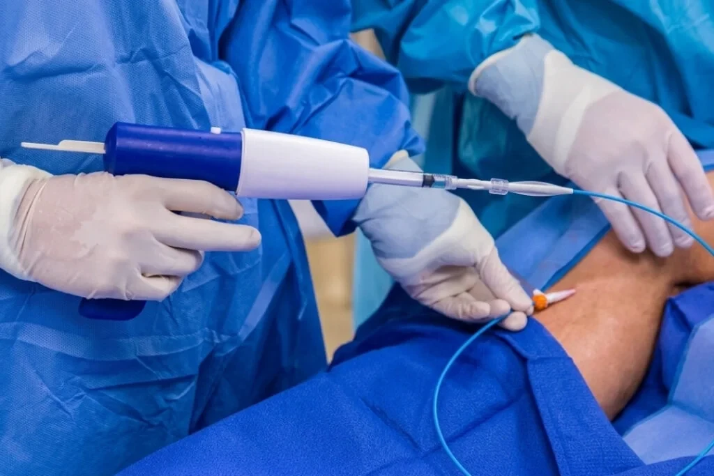 Venaseal Treatment in Mumbai