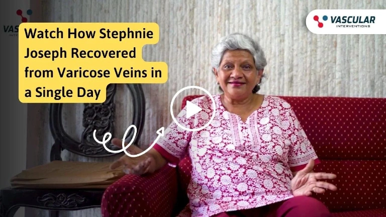 Varicose Vein Patient