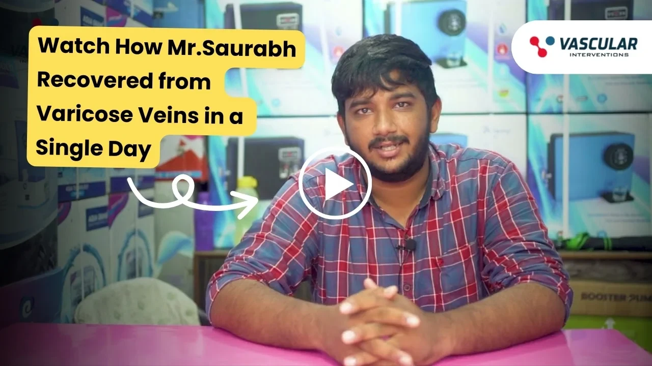 varicose mr.saurabh 1